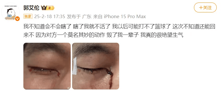 31岁郭艾伦直言想回国家队,但应该没什么机会了,此前眼睛被队友误伤,缝了40多针